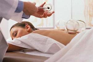 Cupping-&-acupunture-pic-google